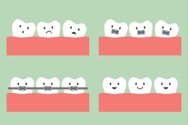 牙齒矯正 牙齒矯正