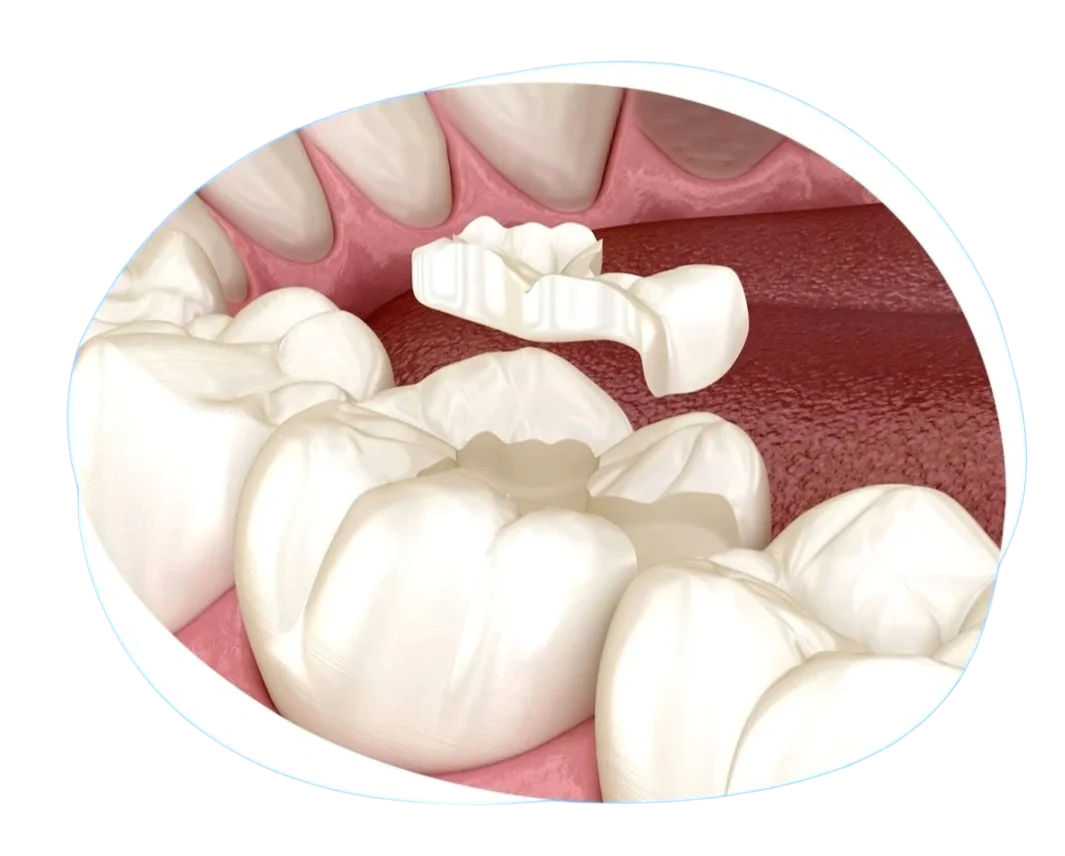 9b71e16f-7ca0-4645-8e81-0bc54183b4d7 9b71e16f-7ca0-4645-8e81-0bc54183b4d7